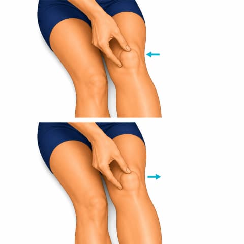Patellar Mobilization exercise illustration